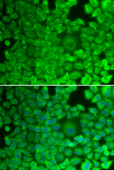 a03512 1 gys1 primary antiboties if testing 2