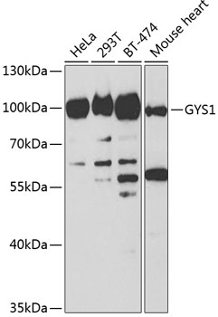 a03512 1 gys1 primary antiboties wb testing 4
