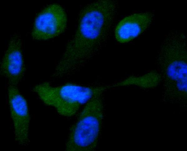 ICC staining Glycogen synthase in PC-3M cells (green)