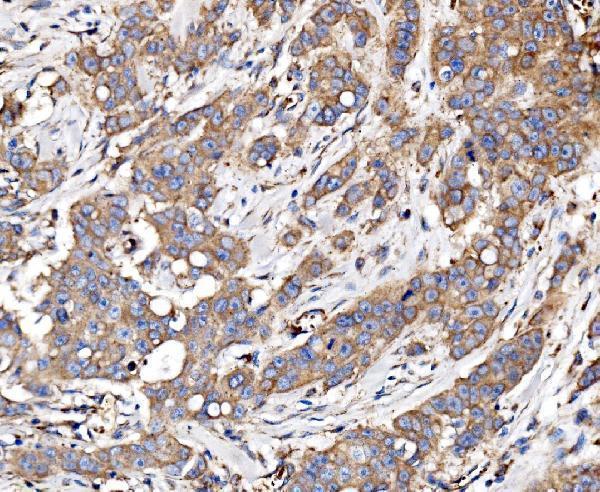 IHC analysis of Glycogen synthase 1/GYS1 using anti-Glycogen synthase 1/GYS1 antibody (A03512-3)