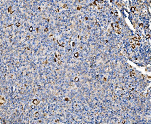  IHC analysis of Glycogen synthase 1/GYS1 using anti-Glycogen synthase 1/GYS1 antibody (A03512-3)