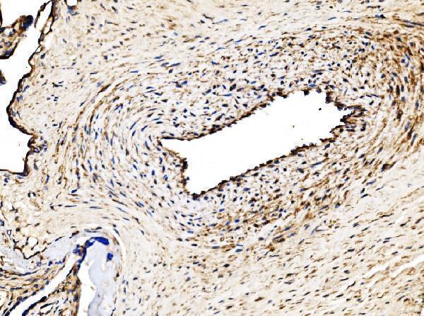 a03512 3 gys1 primary antibodies ihc testing 4
