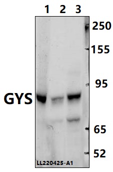a03512 gys1 primary antiboties wb testing 1