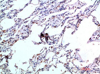 Immunohistochemistry validation of CCL24 using Anti-Eotaxin-2 CCL24 Antibody (A03513)