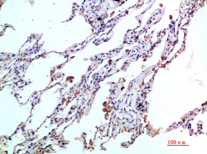 Immunohistochemistry validation of CCL24 using Anti-Eotaxin-2 CCL24 Antibody (A03513)