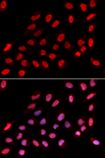 Immunohistochemistry of paraffin-embedded rat liver using NONO/p54nrb Rabbit pAb  at dilution of 1:100 