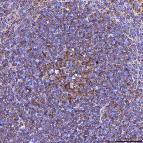 a03516 2 tnfsf14 primary antibodies ihc testing 2