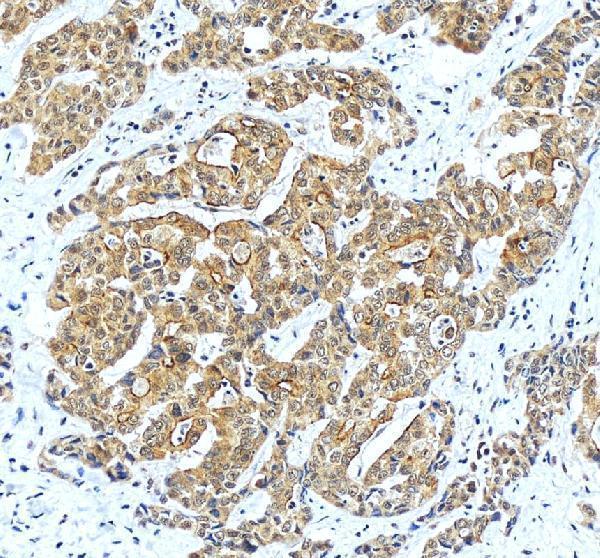 IHC analysis of LIGHT/TNFSF14 using anti-LIGHT/TNFSF14 antibody (A03516-2)