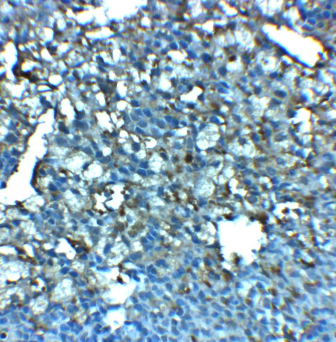 Immunohistochemistry of LRRC8A in rat spleen tissue with LRRC8A antibody at 2