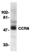 a03518 ccr8 primary antibodies wb testing 1