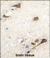Formalin-fixed and paraffin-embedded human brain tissue reacted with ACHE antibody (N-term), which was peroxidase-conjugated to the secondary antibody, followed by DAB staining