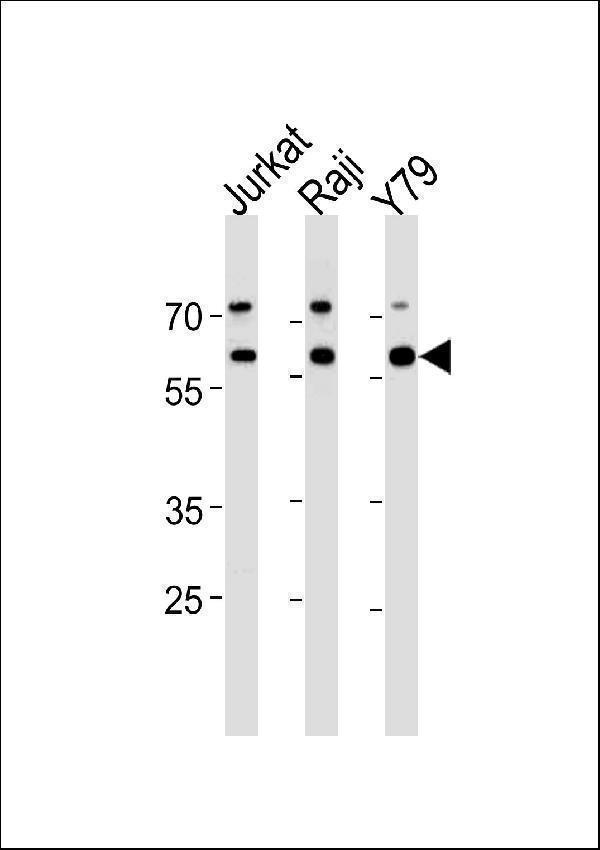ACHE Antibody (N-term) western blot analysis in Jurkat,Raji,Y79 cell line lysates (35ug/lane)