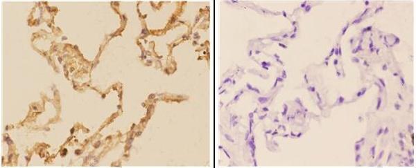 a03519 ache primary antiboties ihc testing 2