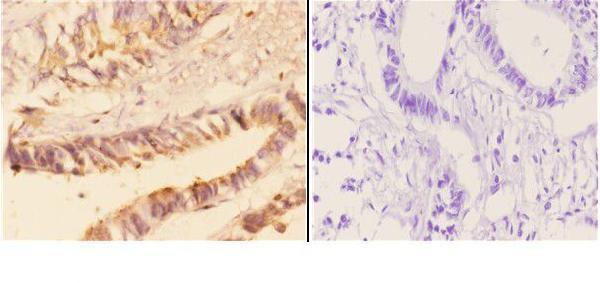 a03519 ache primary antiboties ihc testing 3
