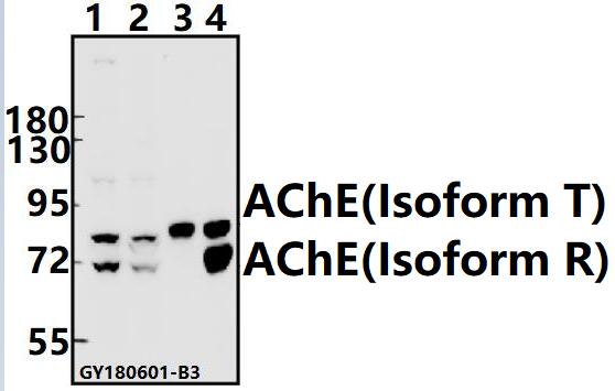 a03519 ache primary antiboties wb testing 1