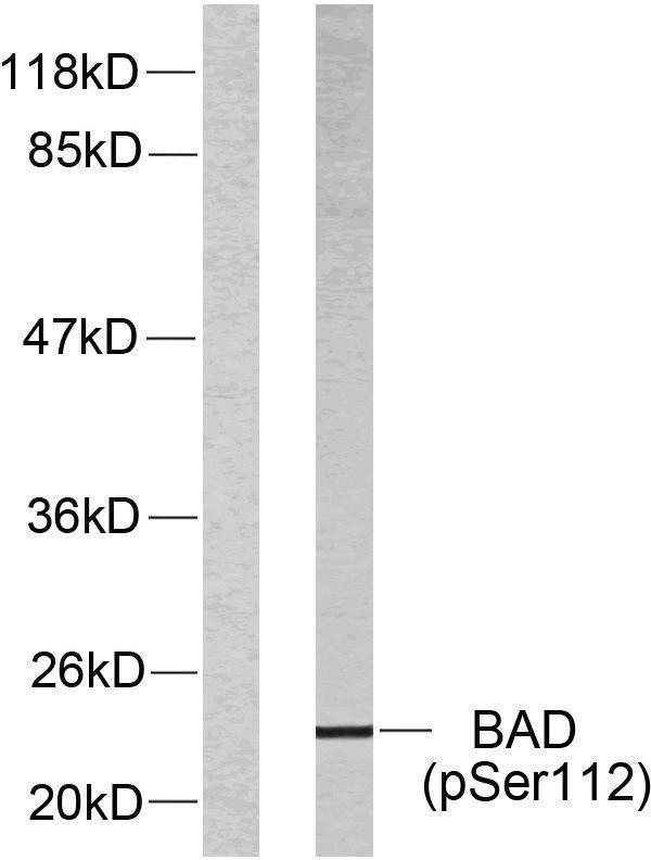 Western blot analysis of lysates from 293 cells treated with Forskolin, using BAD (Phospho-Ser112) Antibody