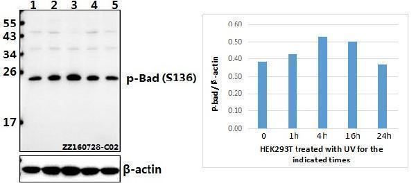 Western blot (WB) analysis of Bad (phospho-S136) polyclonal antibody at 1:500 dilution
Lane1:HEK293T whole cell lysate(40ug)
Lane2:HEK293T treated with UV for 1h whole cell lysate(40ug)
Lane3:HEK293T treated with UV for 4h whole cell lysate(40ug)
Lane4:HEK293T treated with UV for 16h whole cell lysate(40ug)
Lane5:HEK293T treated with UV for 24h whole cell lysate(40ug)