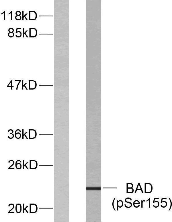 Western blot analysis of lysates from 293 cells treated with Forskolin, using BAD (Phospho-Ser155) Antibody