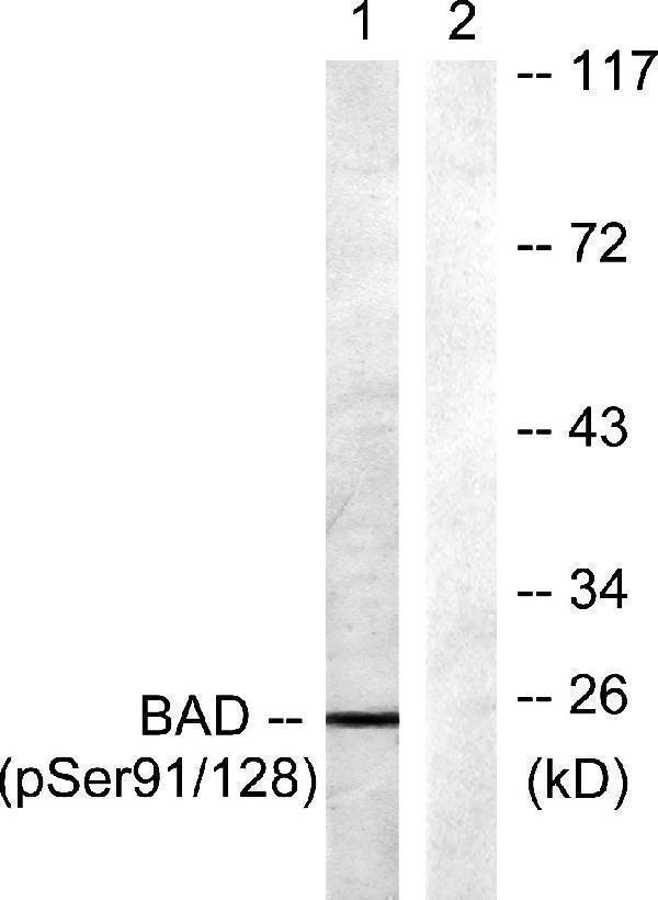 Western blot analysis of lysates from COS7 cells treated with TNF-a 20ng/ml+Calyculin A 50nM 5', using BAD (Phospho-Ser91/128) Antibody