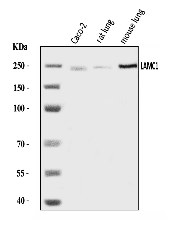  Western blot analysis of Laminin Gamma 1/LAMC1 using anti-Laminin Gamma 1/LAMC1 antibody (A03522-2)