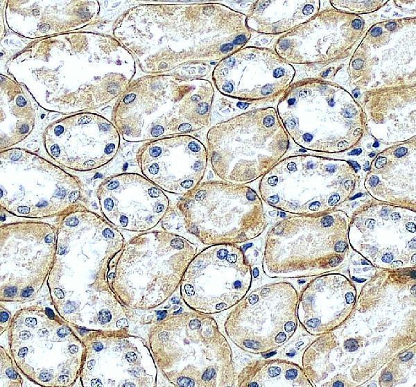 a03522 lamc3 primary antibodies ihc testing 6