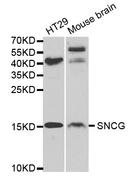 Western blot (WB) analysis of Synoretin polyclonal antibody