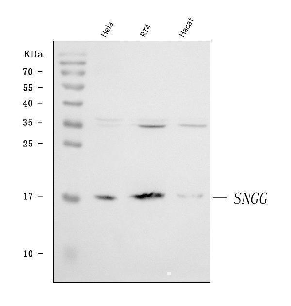  Western blot analysis of gamma Synuclein/SNCG using anti-gamma Synuclein/SNCG antibody (A03523-4)