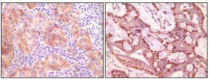 a03523 sncg primary antibodies ihc testing 1