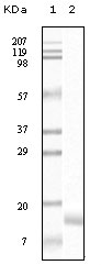 a03523 sncg primary antibodies wb testing 2
