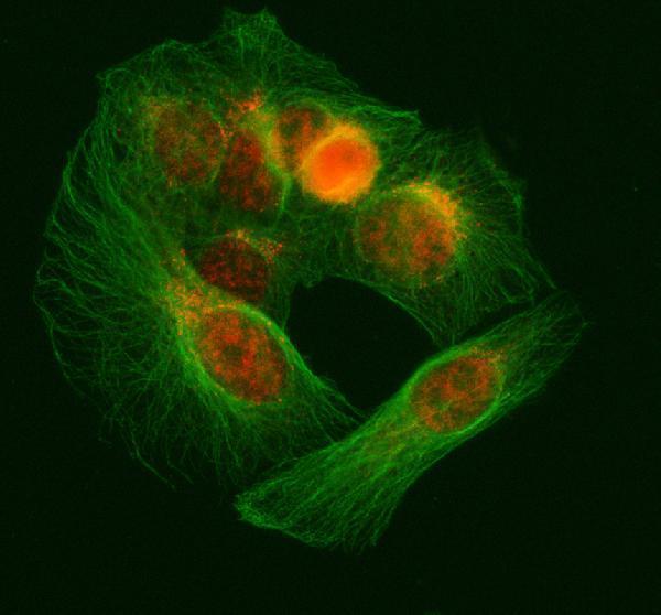a03527 2 snrnp70 primary antibodies if testing 6