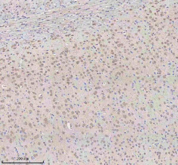 a03527 2 snrnp70 primary antibodies ihc testing 2