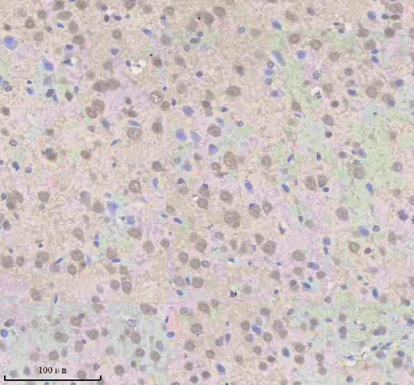 a03527 2 snrnp70 primary antibodies ihc testing 3