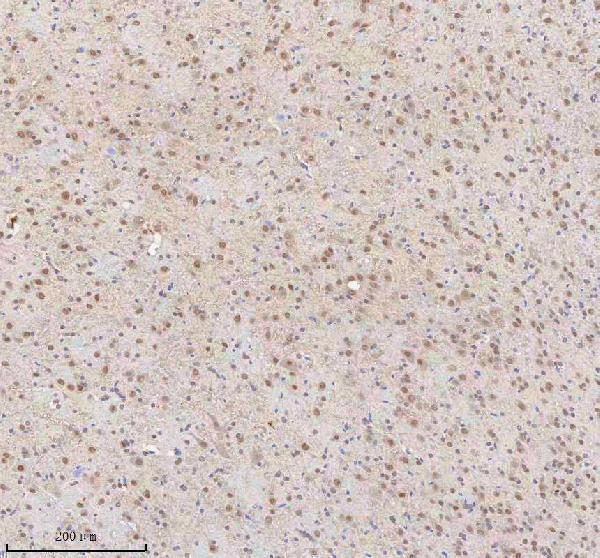 a03527 2 snrnp70 primary antibodies ihc testing 4