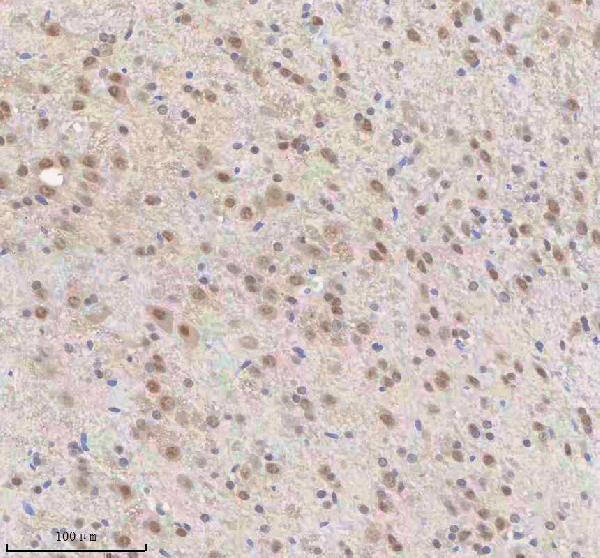 a03527 2 snrnp70 primary antibodies ihc testing 5