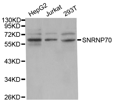 a03527 snrnp70 primary antiboties wb testing 1