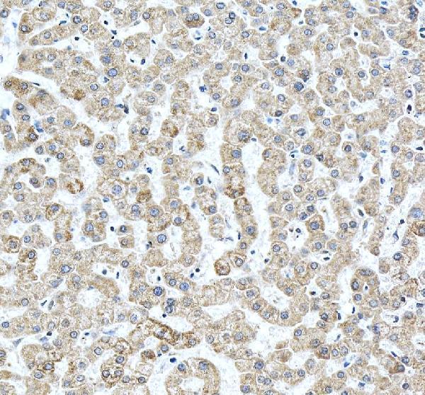 IHC analysis of Cytochrome c/CYCS using anti-Cytochrome c/CYCS antibody (A03529)