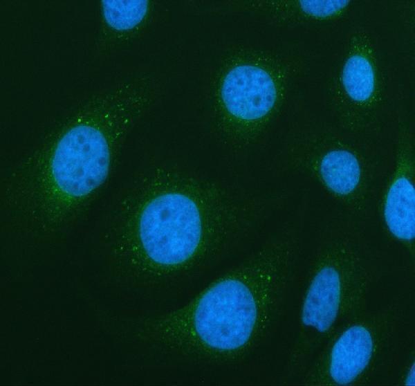 IF analysis of PIK3C2A using anti-PIK3C2A antibody (A03530-2)