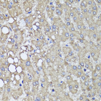 a03530 pik3c2a primary antiboties ihc testing 2