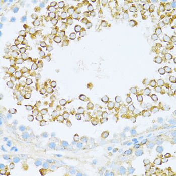 Immunohistochemistry of paraffin-embedded rat testis using DVL1 antibody  at dilution of 1:100 