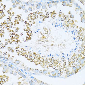 Immunohistochemistry of paraffin-embedded mouse testis using DVL1 antibody  at dilution of 1:100 