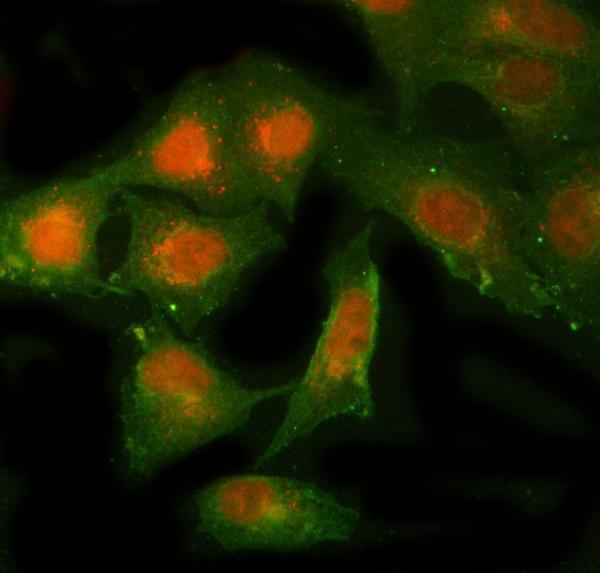  IF analysis of NBR1 using anti-NBR1 antibody (A03534-1) and anti-Beta Tubulin antibody (M01857-3)