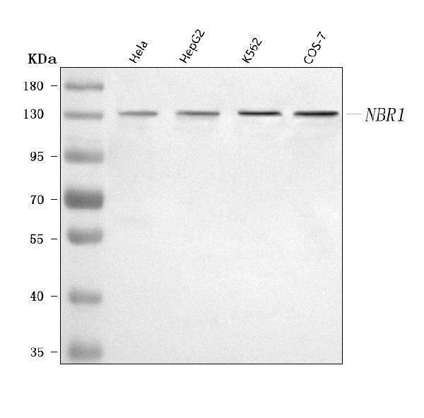  Western blot analysis of NBR1 using anti-NBR1 antibody (A03534-1)