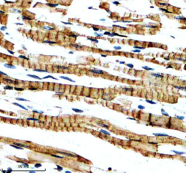 IHC analysis of NBR1 using anti-NBR1 antibody (A03534-2)