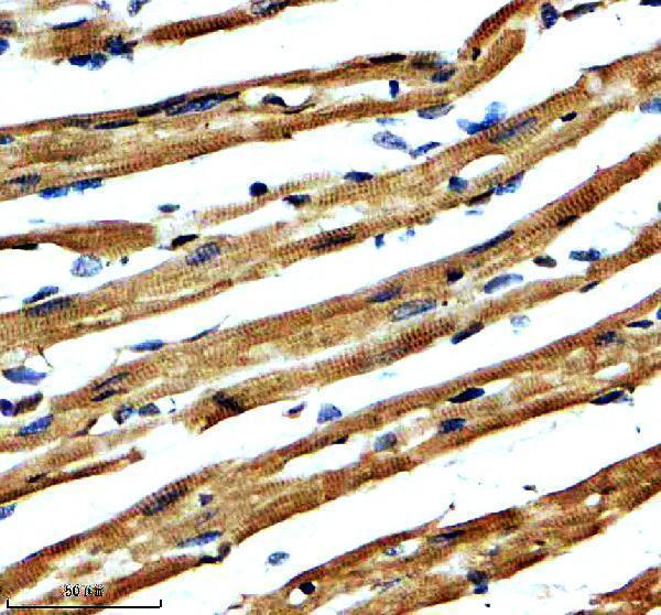 IHC analysis of NBR1 using anti-NBR1 antibody (A03534-2)