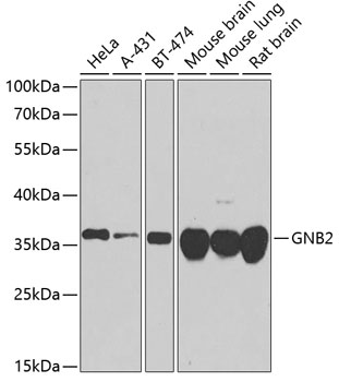 a03535 gnb2 primary antiboties wb testing 1