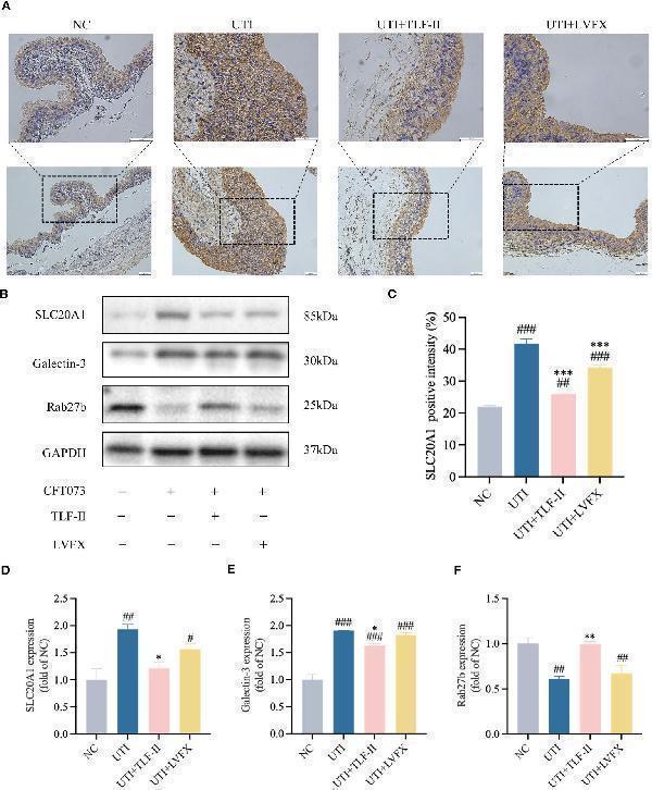 TLF-II protects fusiform vesicles and inhibits the occurrence of immune escape in bacteria