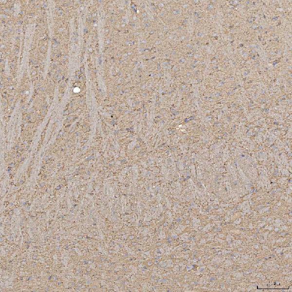 a03537 1 slc20a1 primary antibodies ihc testing 10