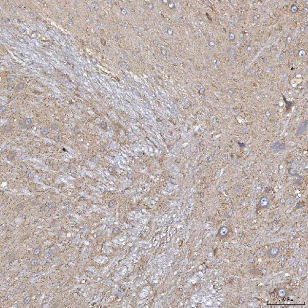 a03537 1 slc20a1 primary antibodies ihc testing 11