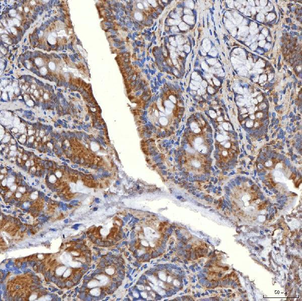 a03537 1 slc20a1 primary antibodies ihc testing 12