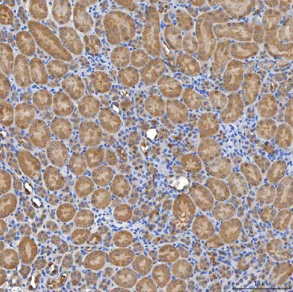 a03537 1 slc20a1 primary antibodies ihc testing 13